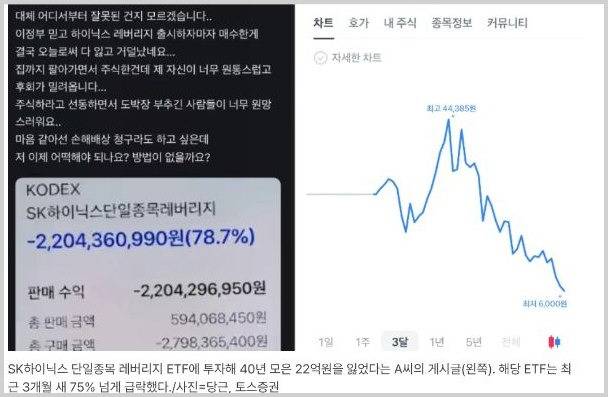 SK하이닉스 레버리지